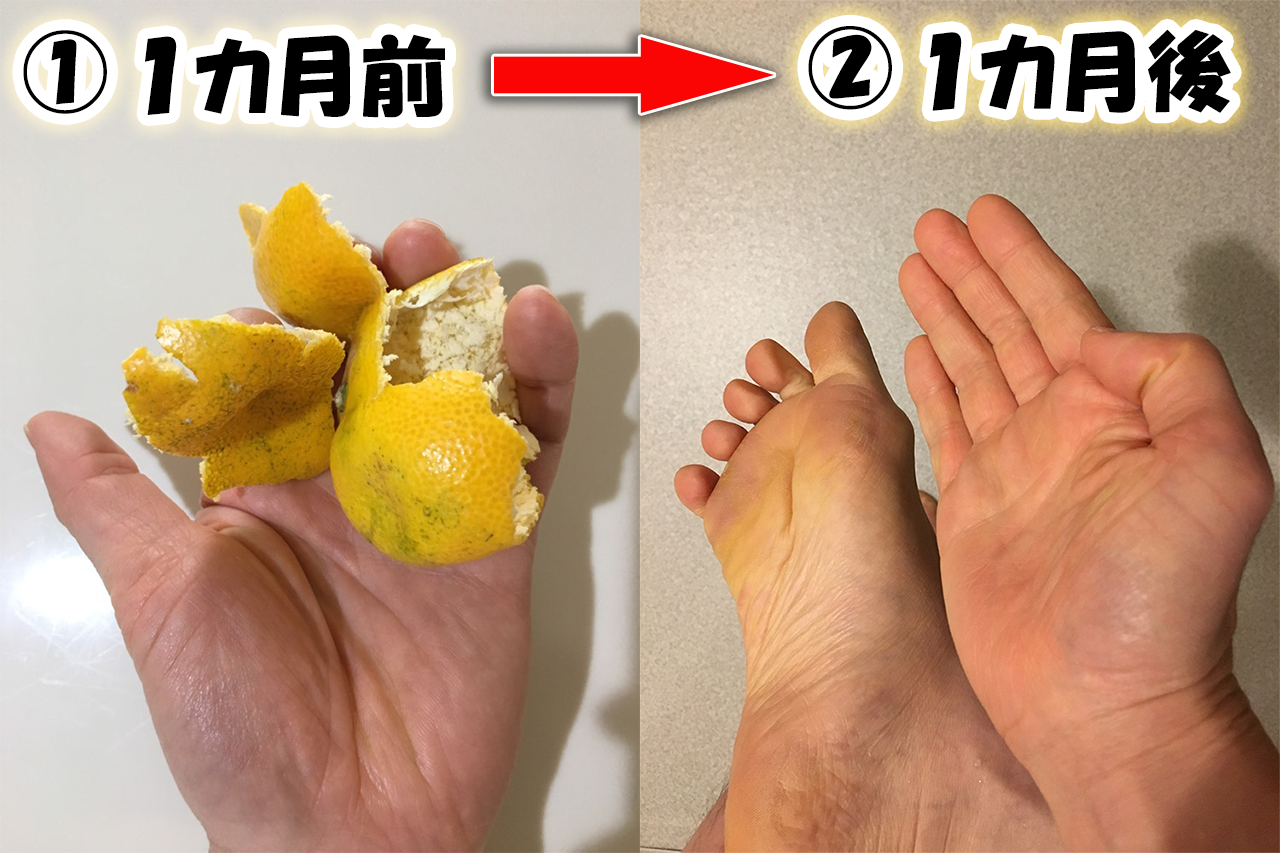 緑黄色野菜・果物を食べると肌が黄色くなる柑皮症(かんぴしょ …